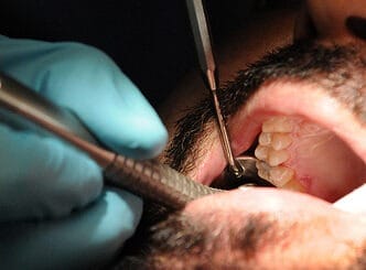 free dental clinic