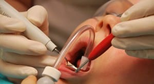 Dental Plans