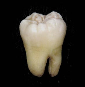 Teeth Stained