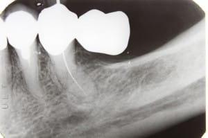 Dental Examinations