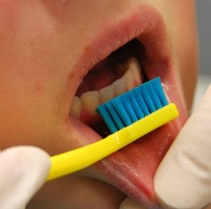 Preventative Dental Care