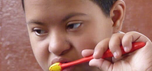 People with Down Syndrome