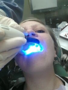 dental_procedure