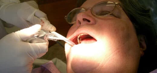 Dental Hygienists